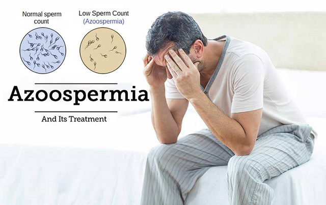 Azoospermia-and-Its-Treatment
