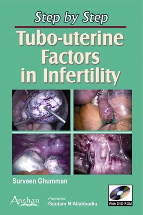 Award for Best IVF Doctor Tubo-uterine Factors in Infertility